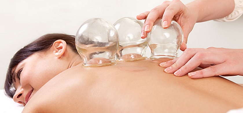 Cupping Therapy In Austin Texas